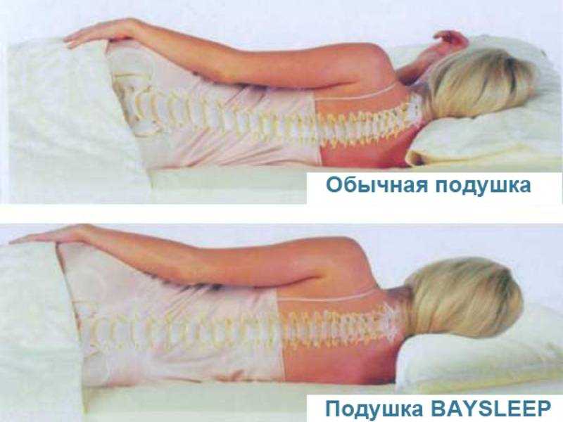 Какую пользу или вред принесет организму сон без подушки